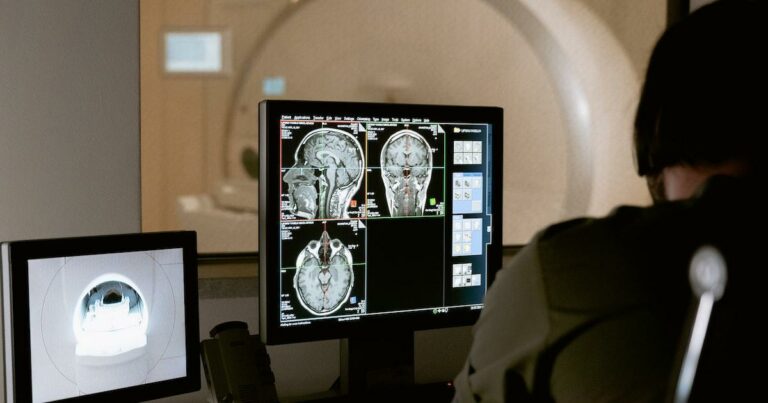 Brain scan for traumatic brain injury