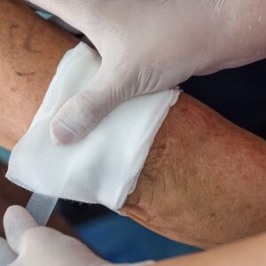 Wounds Stages of Healing