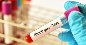 ABG Interpretation