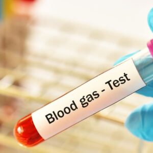 ABG Interpretation