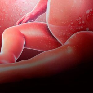 Amniotic Fluid Embolism